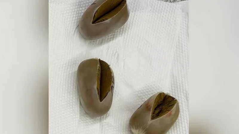 Customs seize egg‑shaped gold packets from passenger at Dhaka airport